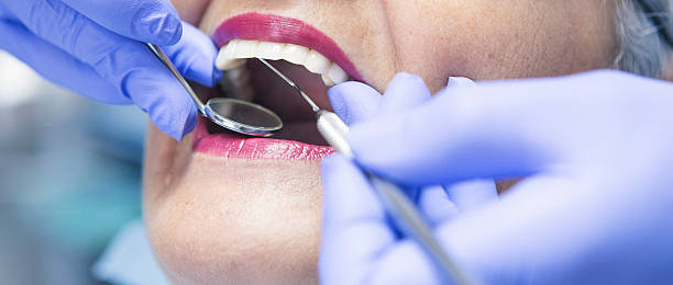 Best Emergency Treatment for Dental Infections or Abscesses in Addison, TX
